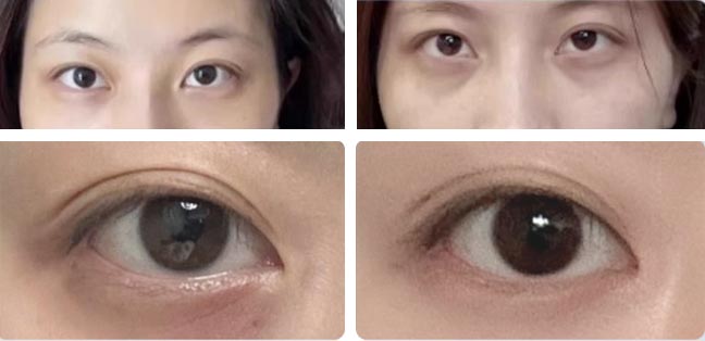 Soothing Eye Spa Mask